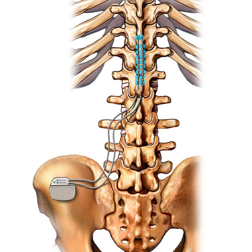 neuromodulation neuromodulation